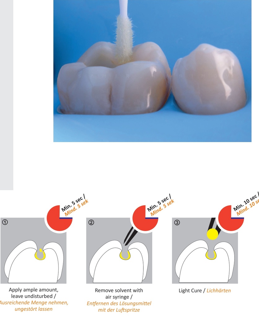 Prebond adhesivo Universal 5ml PD